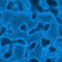 Toxic Mold Microscope View